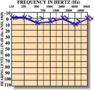 prequency in herts Hz